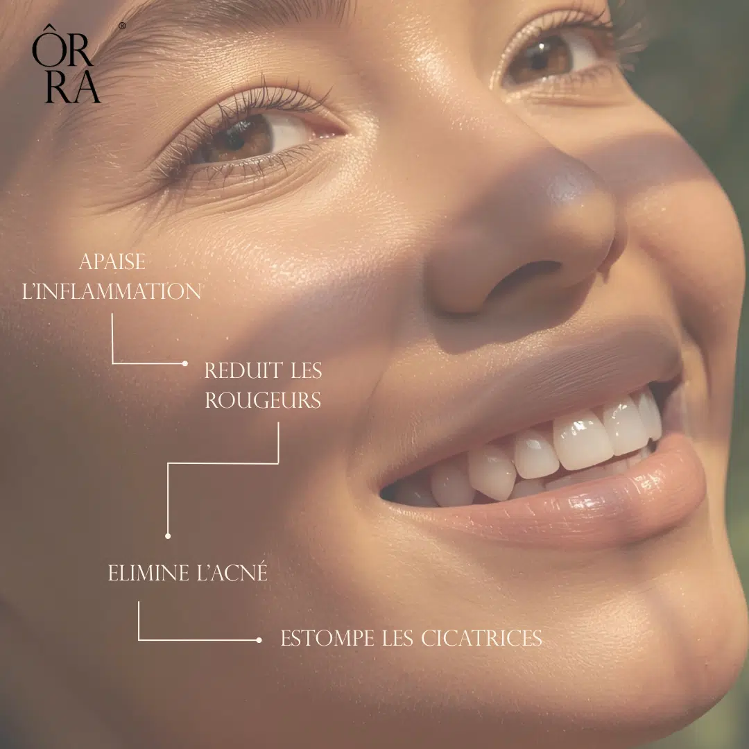 visuel_acné pack découverte huile figue de barbarie 10ml et savon naturel ÔRRA